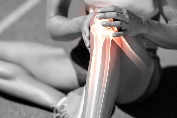 Runner’s Knee