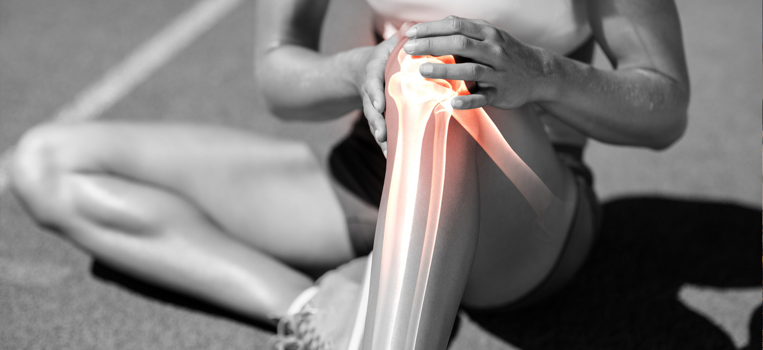 Runner’s Knee